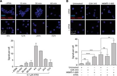 Dual inhibition of EZH2 and G9A/GLP histone methyltransferases by HKMTI-1-005 promotes differentiation of acute myeloid leukemia cells